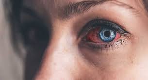 اگر با لنز بخوابیم چه مشکلاتی برای چشم ایجاد می‌شود؟